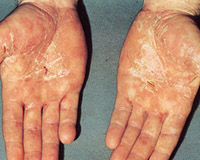 医療チームの変更